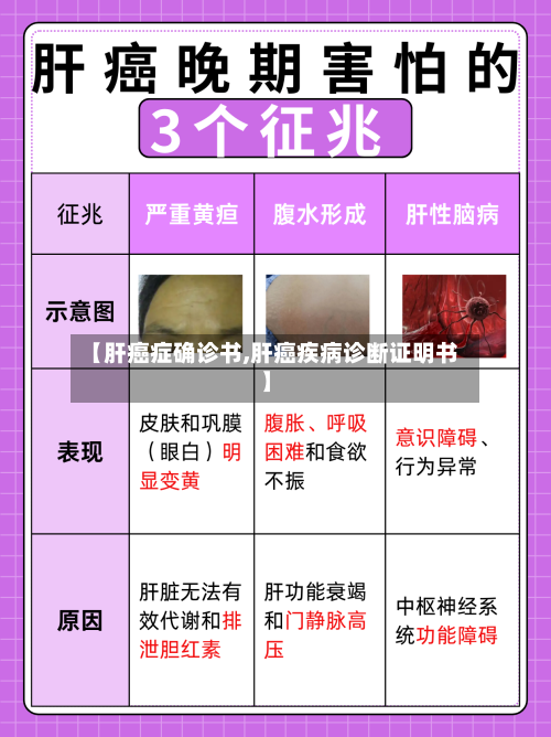 【肝癌症确诊书,肝癌疾病诊断证明书】