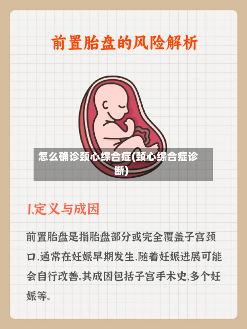 怎么确诊颈心综合症(颈心综合症诊断)-第2张图片