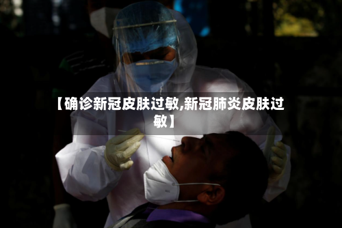 【确诊新冠皮肤过敏,新冠肺炎皮肤过敏】-第2张图片