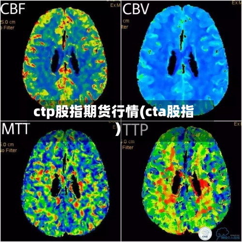 ctp股指期货行情(cta股指)-第3张图片