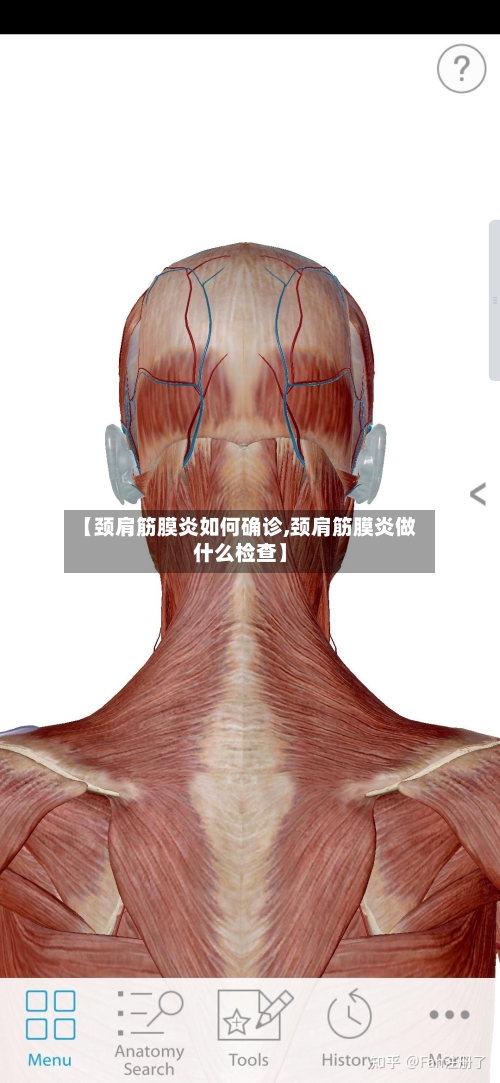 【颈肩筋膜炎如何确诊,颈肩筋膜炎做什么检查】-第2张图片