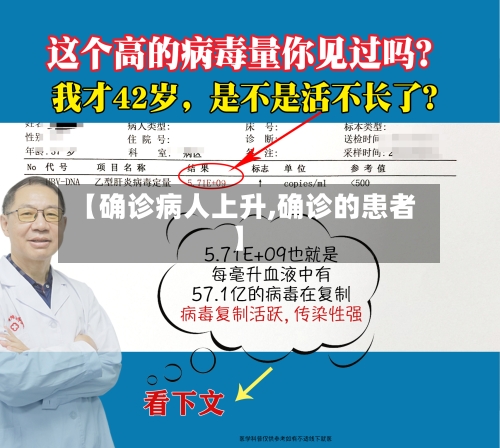 【确诊病人上升,确诊的患者】-第3张图片
