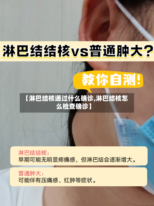 【淋巴结核通过什么确诊,淋巴结核怎么检查确诊】-第1张图片