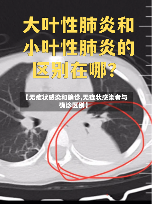 【无症状感染和确诊,无症状感染者与确诊区别】-第1张图片