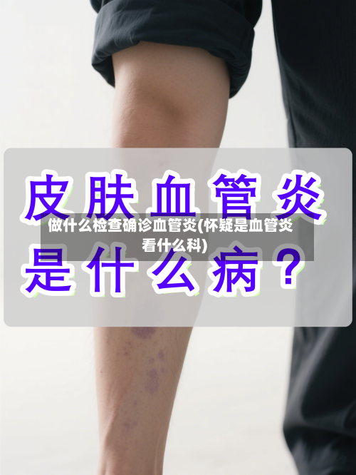 做什么检查确诊血管炎(怀疑是血管炎看什么科)-第2张图片
