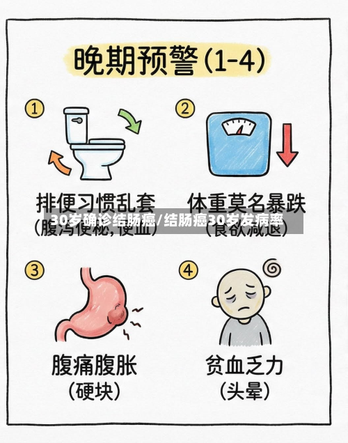 30岁确诊结肠癌/结肠癌30岁发病率