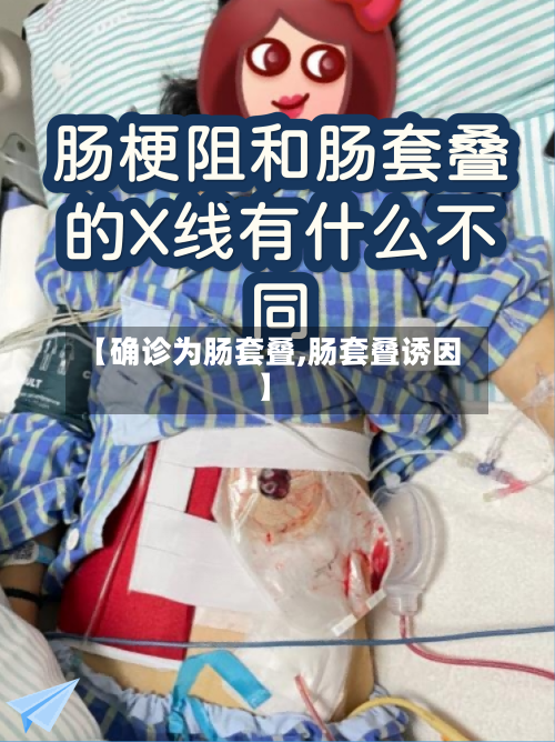 【确诊为肠套叠,肠套叠诱因】