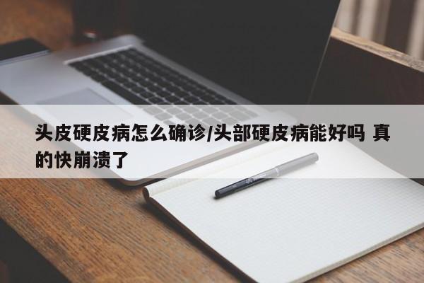 头皮硬皮病怎么确诊/头部硬皮病能好吗 真的快崩溃了